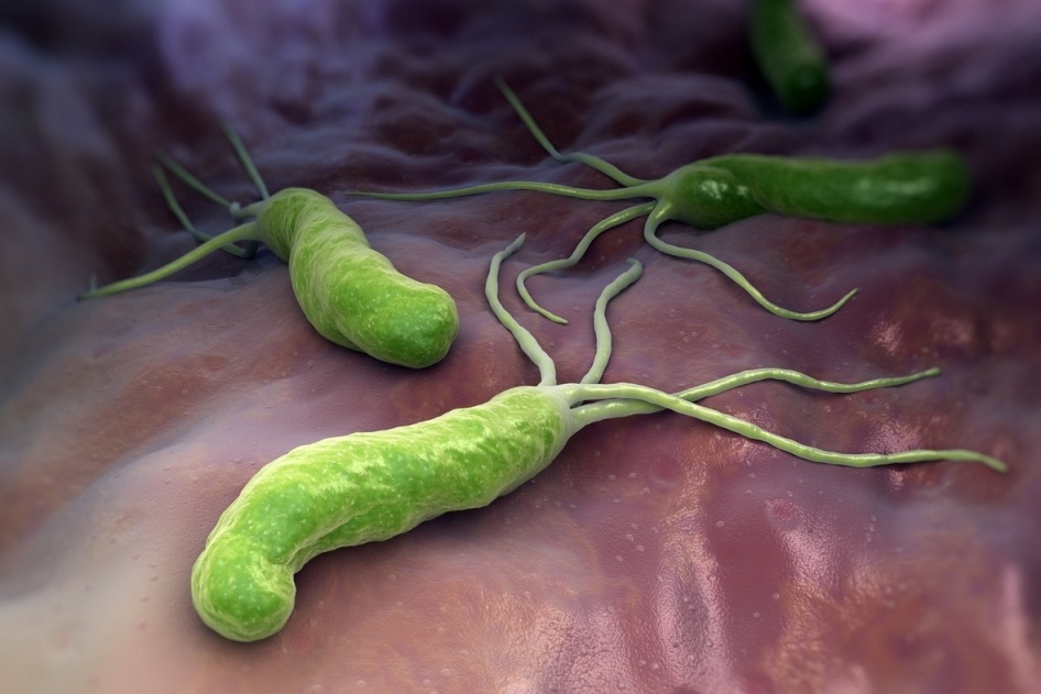 Helicobacter Pylori: o que é? E por que devemos nos preocupar?